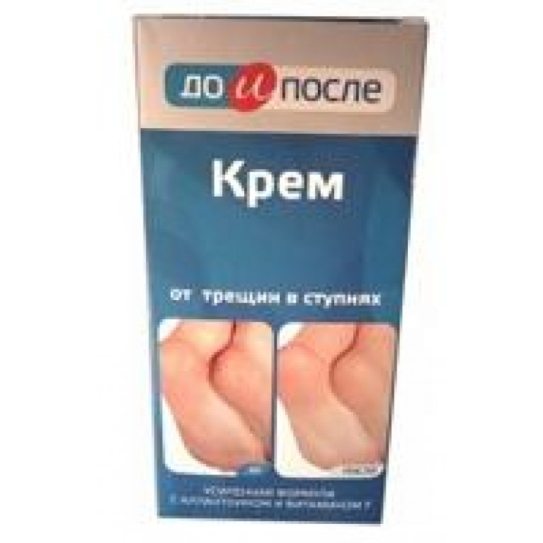 До и После Крем для ног от трещин в ступнях 50мл
