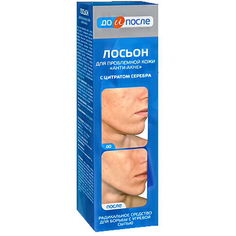 До и После Лосьон Анти-Акне для проблемной кожи с цитратом серебра от угревой сыпи 200мл
