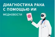 Медицинские новости: Диагностика рака с помощью ИИ
