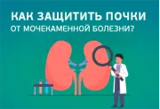 Как защитить почки от образования камней?