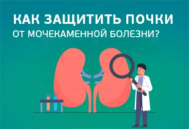Как защитить почки от образования камней?