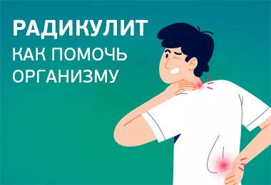 Радикулит: что это и как помочь организму