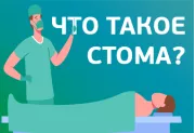 Что такое стома?