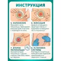 Колопласт Пластина-полукольцо Брава эластичная №1 (12070) Колопласт (Coloplast A/S) (Венгрия) - 4